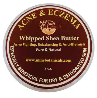 ACNE &amp; Eczema Whipped Shea Butter