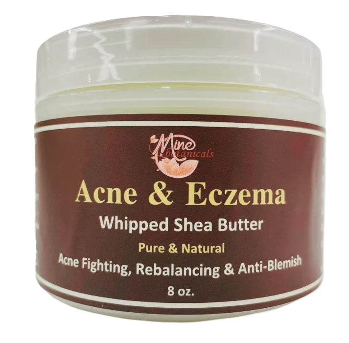 ACNE &amp; Eczema Whipped Shea Butter
